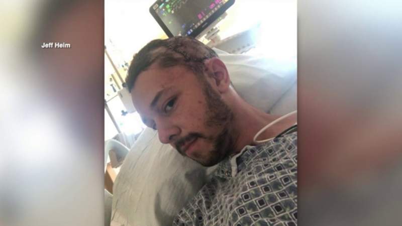 ‘I’m lucky it didn’t death roll:’ Florida man survives alligator bite to the head