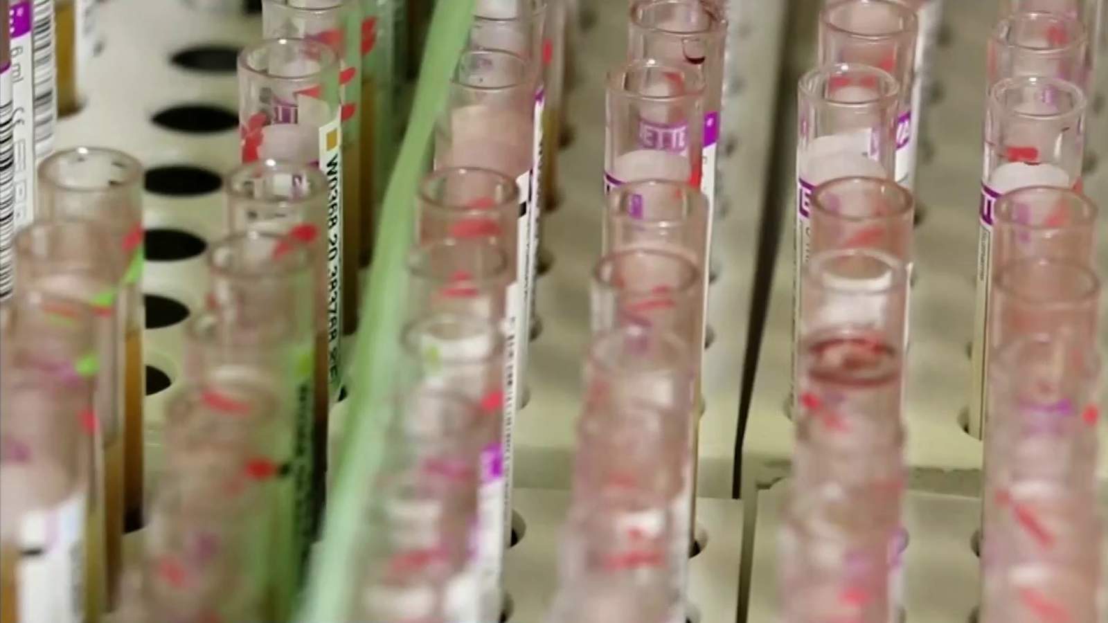 OneBlood to begin testing all donations for coronavirus antibodies