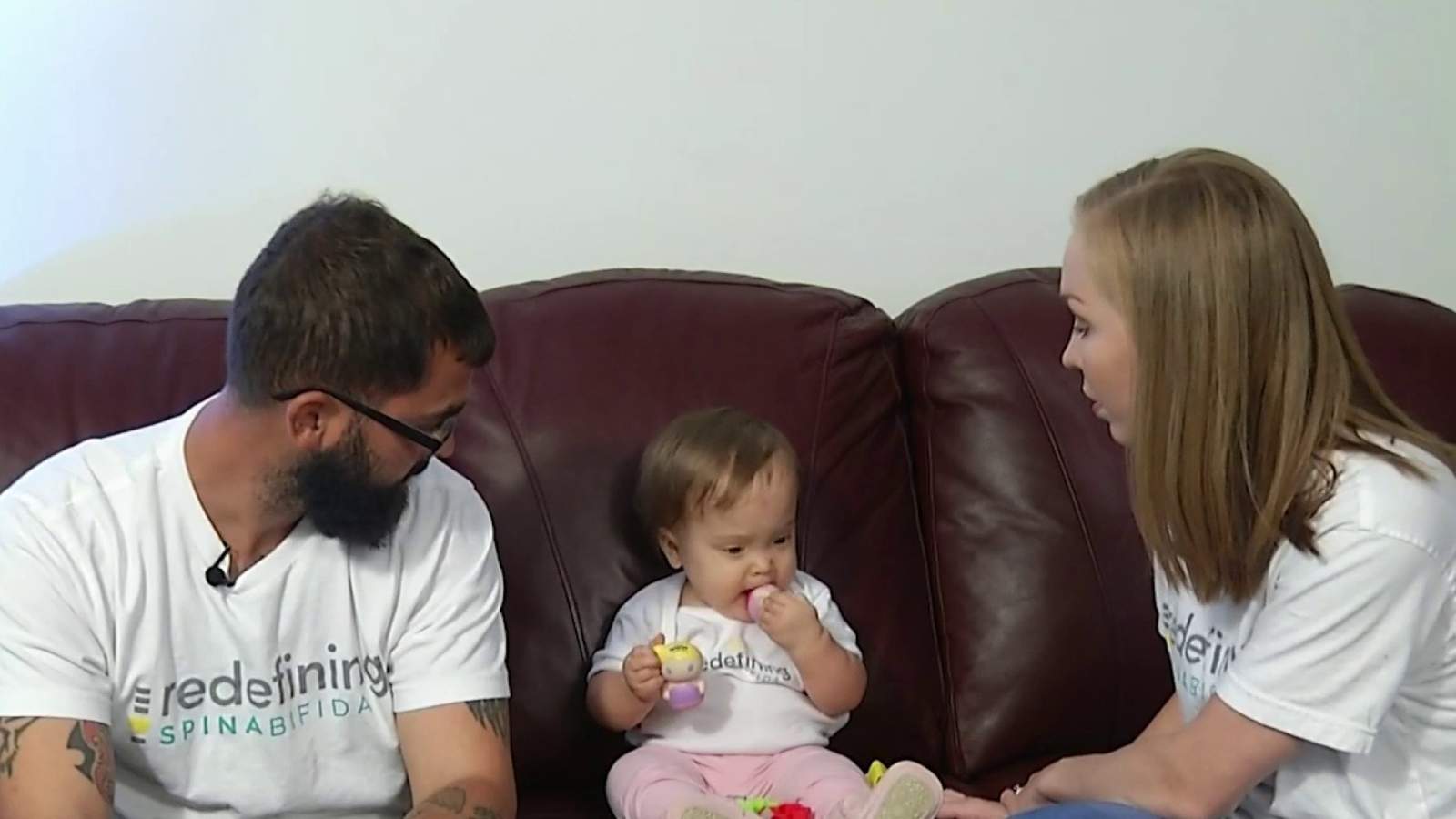 15-month-old thriving after receiving fetal surgery to treat spina bifida