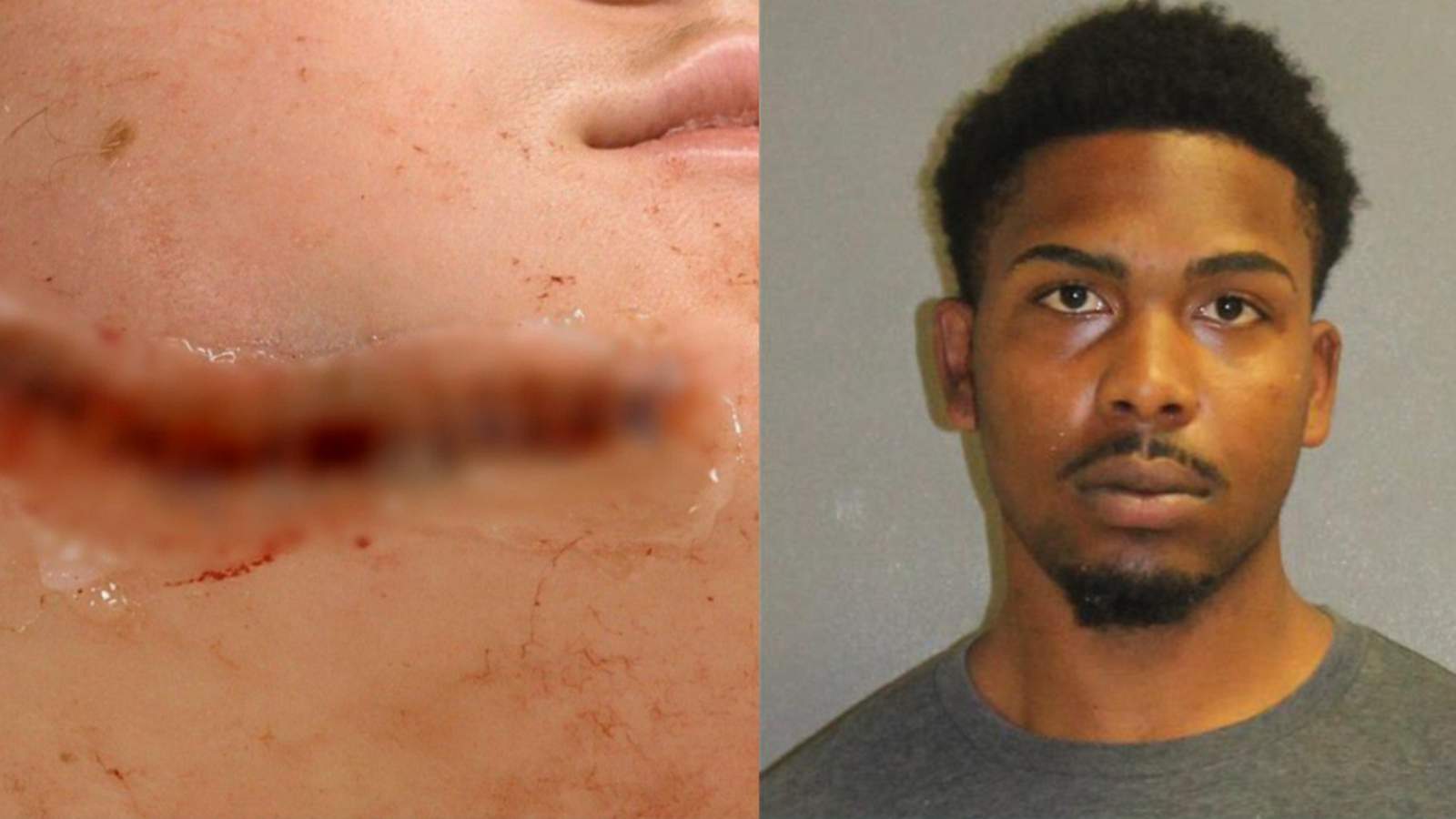 Arrest made in random face-slashing attack that left teen injured in Orange City