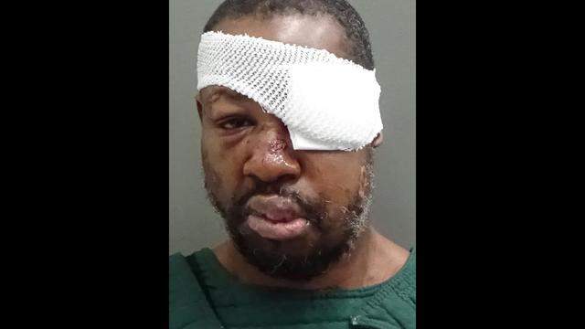 Police investigating use of force in Markeith Loyd arrest